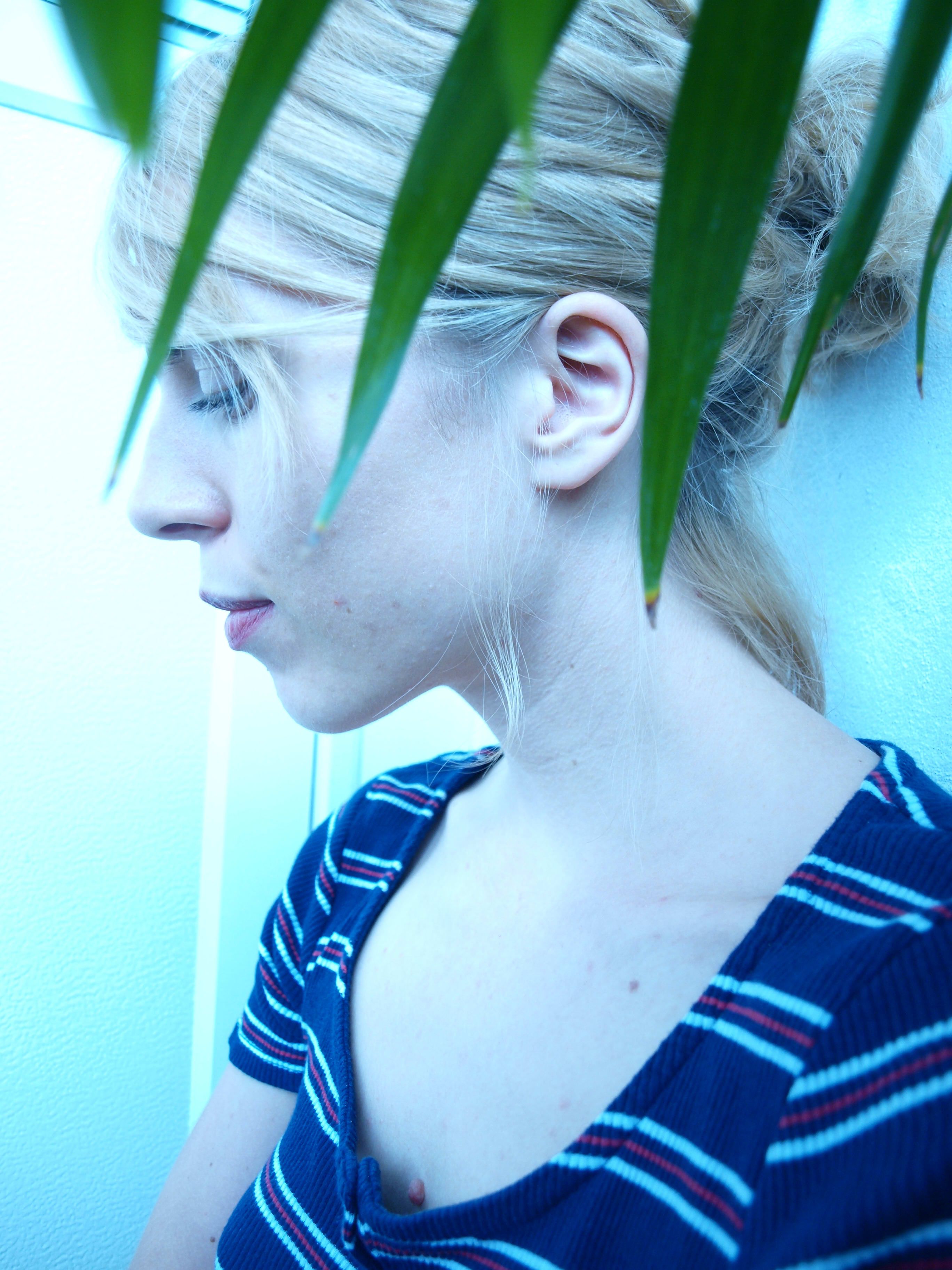 bild 4}