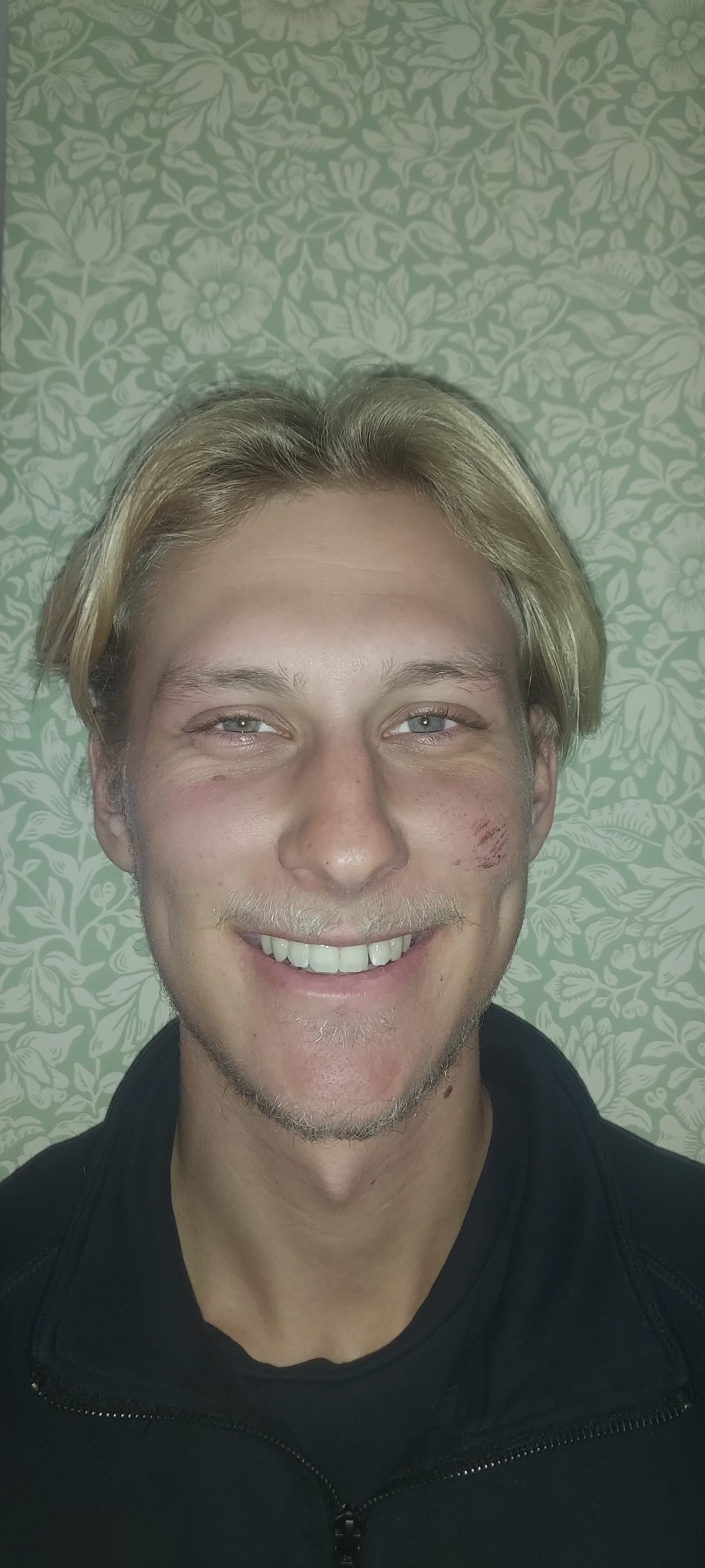bild 0}