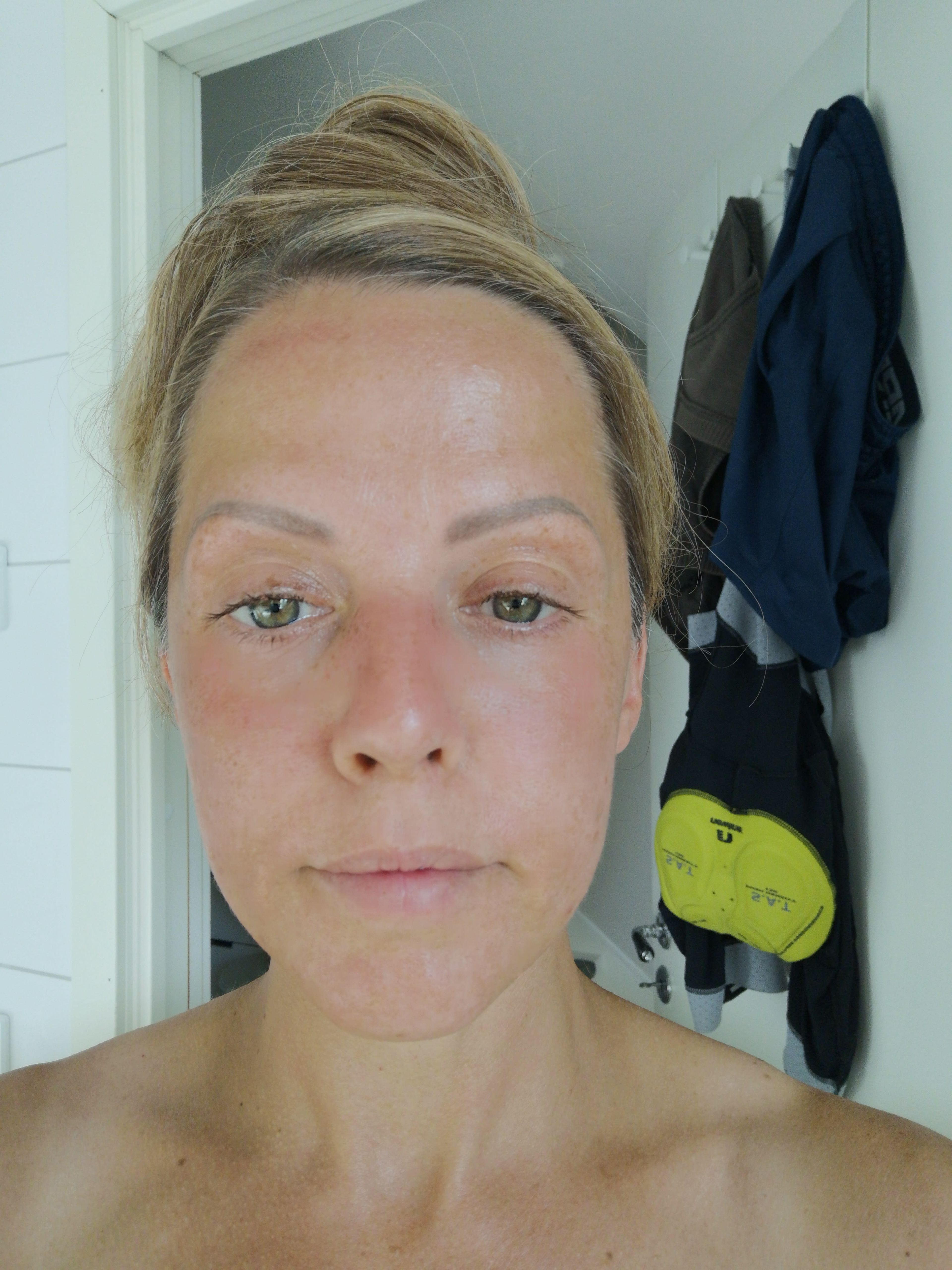 bild 4}