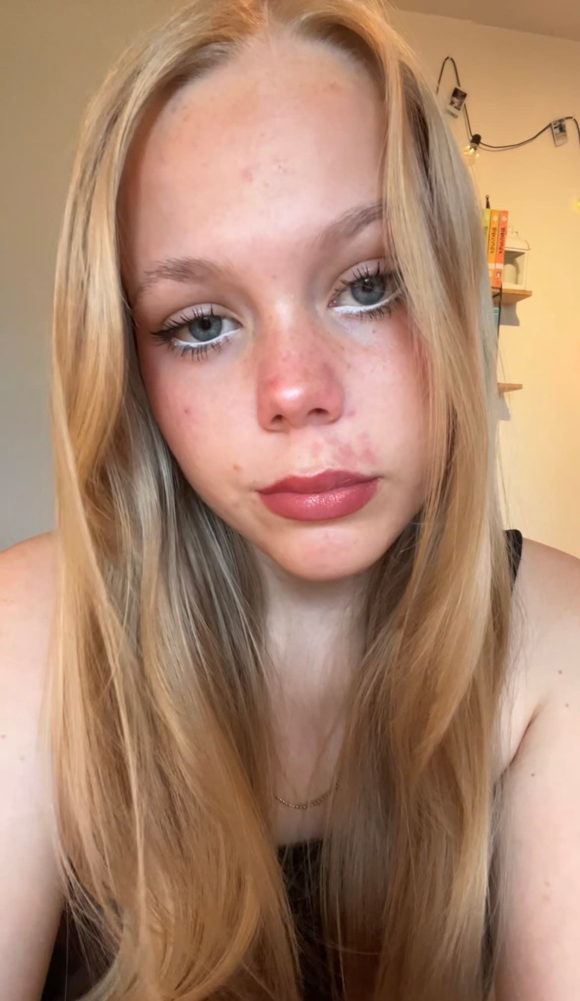 bild 0}