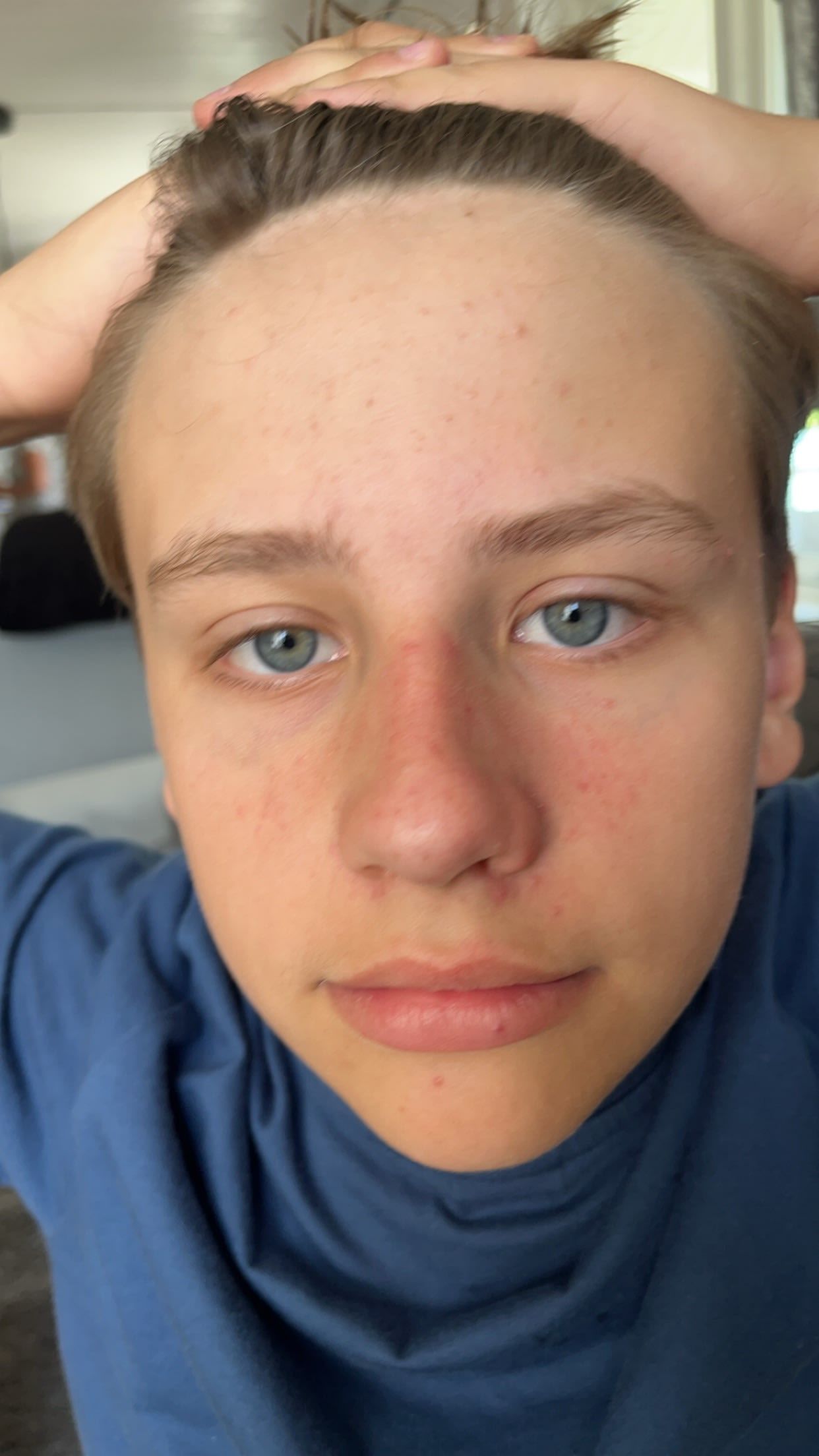 bild 0}
