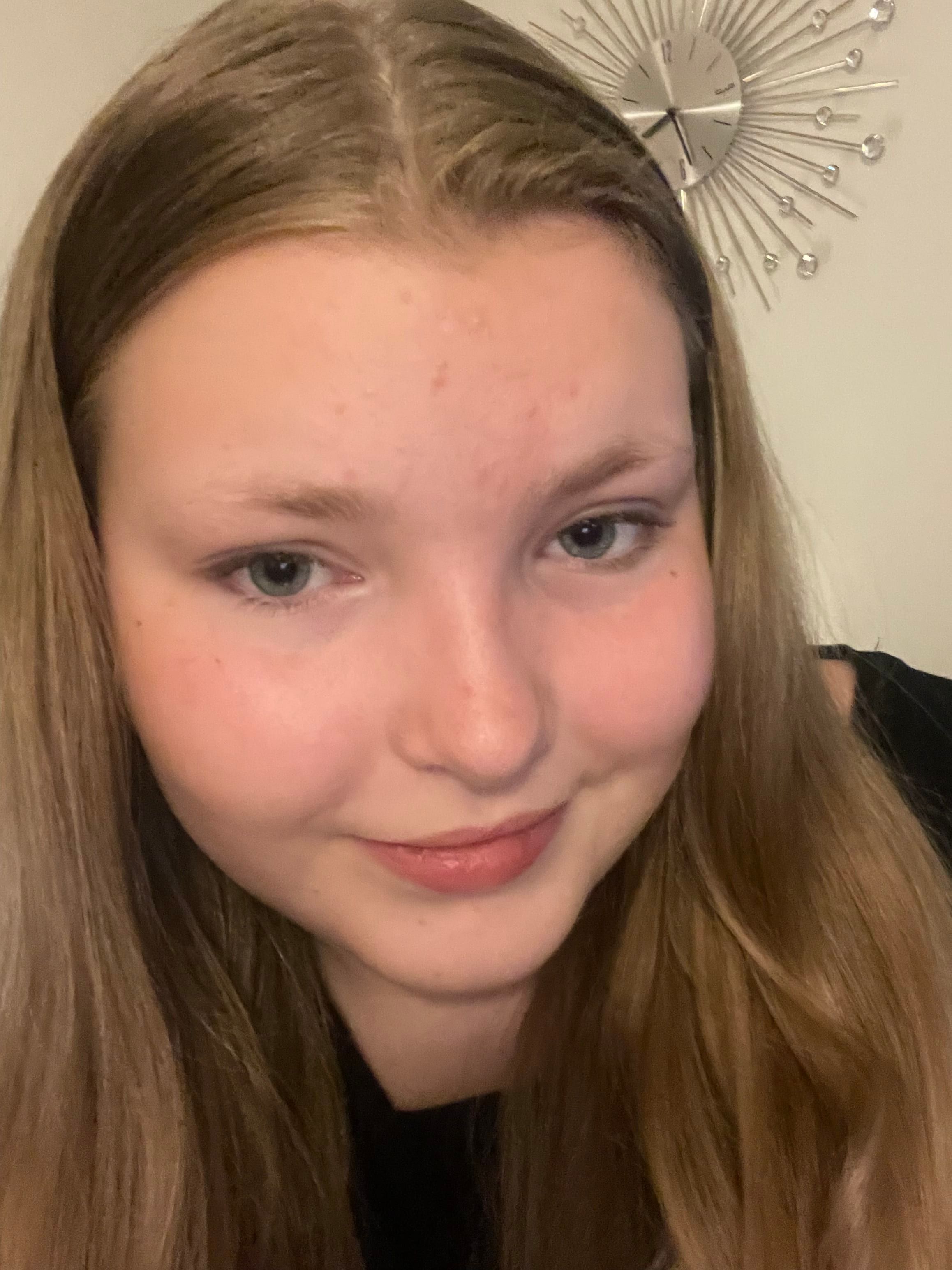 bild 0}