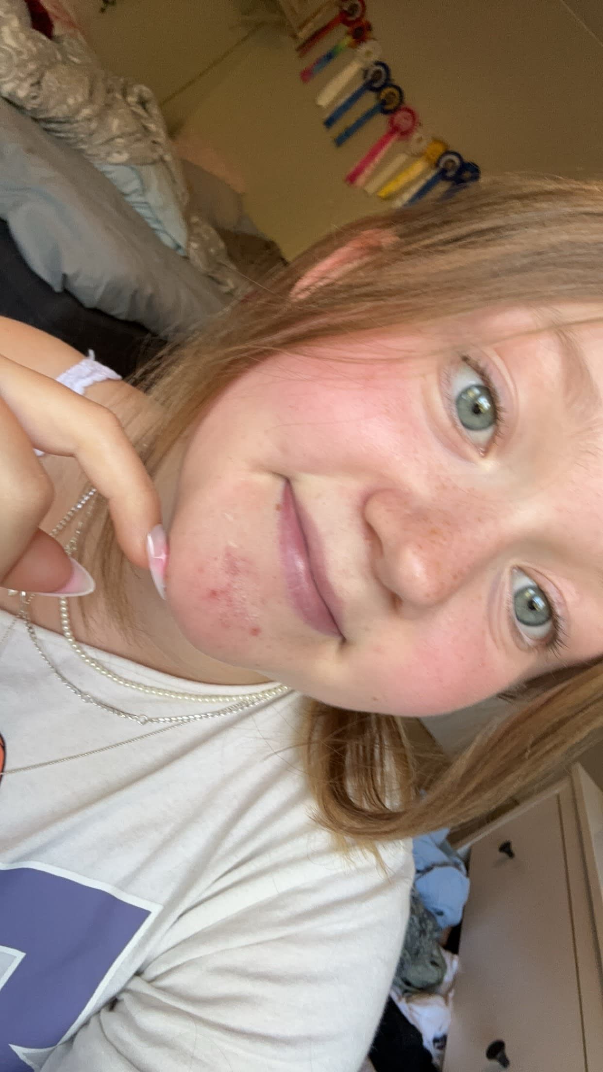 bild 1}