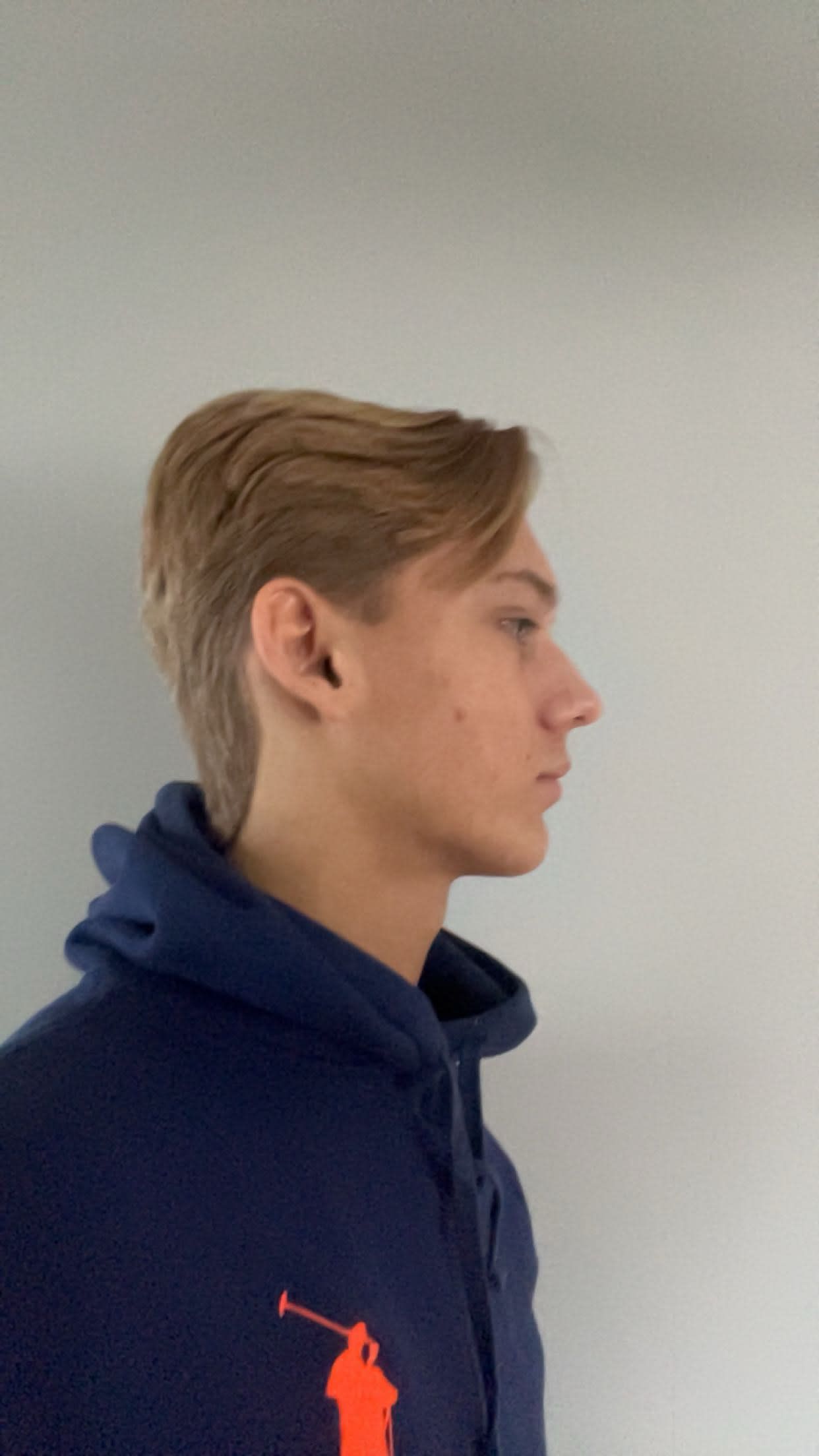 bild 0}