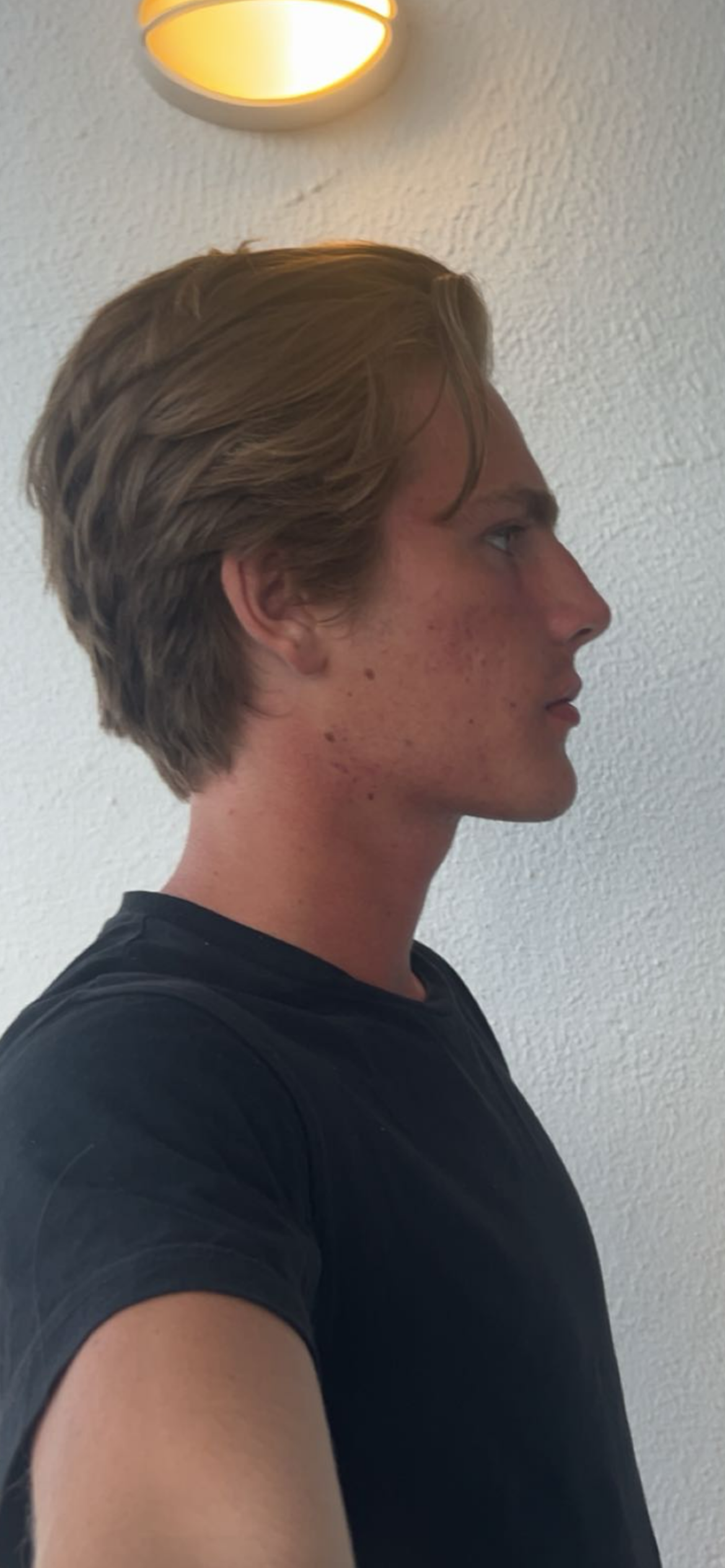 bild 1}