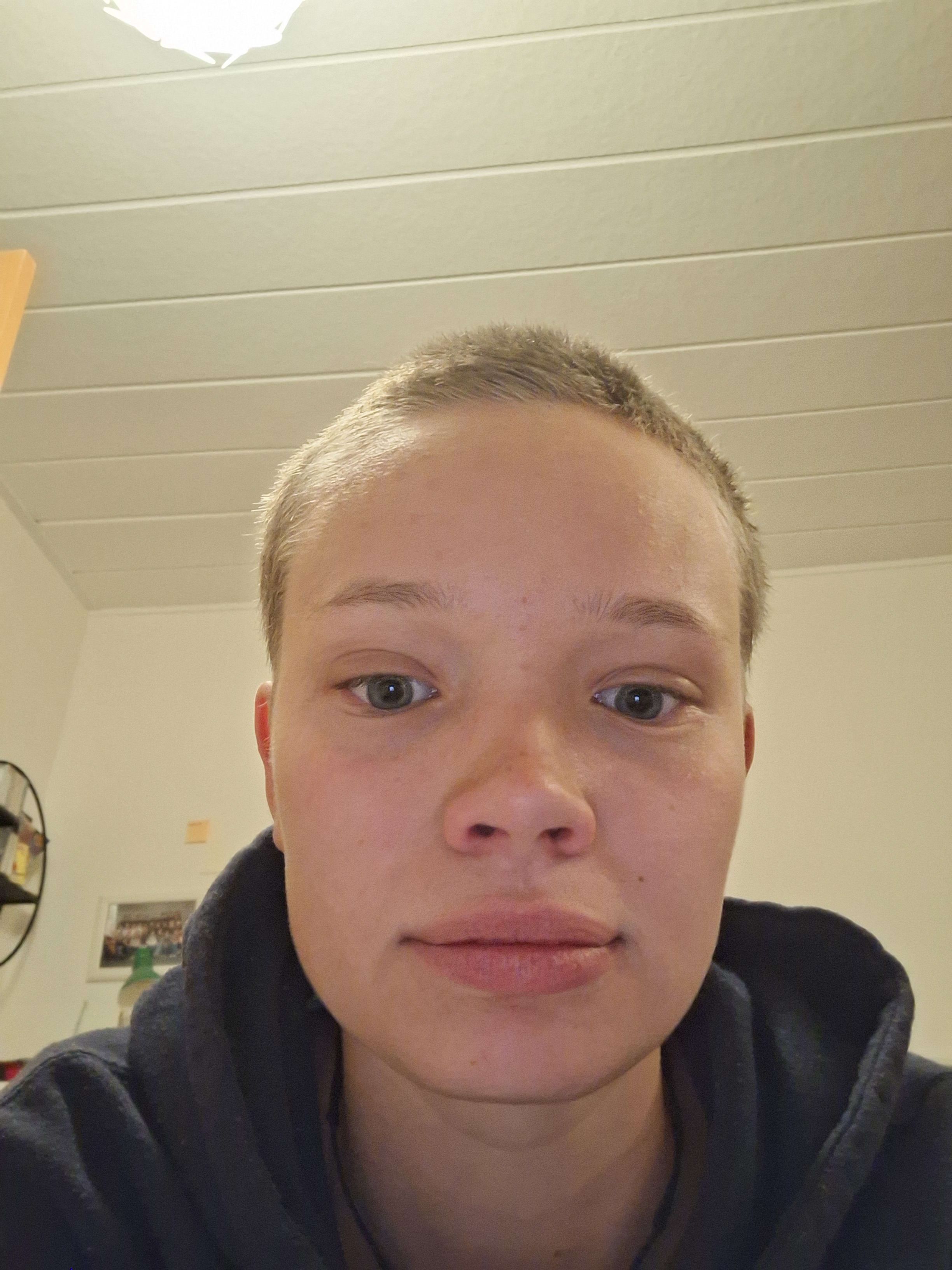 bild 0}
