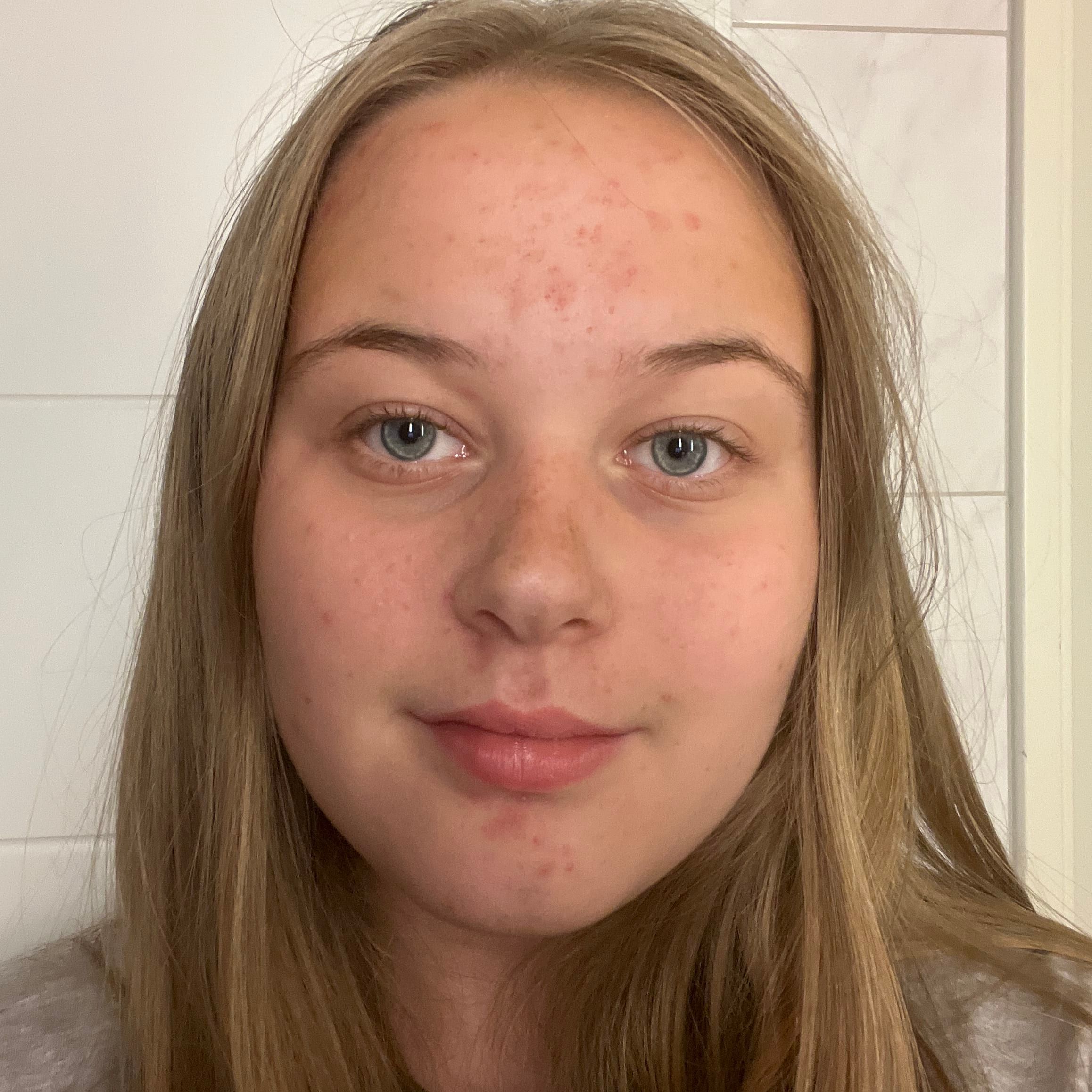 Profilbild för Amanda Skarstig