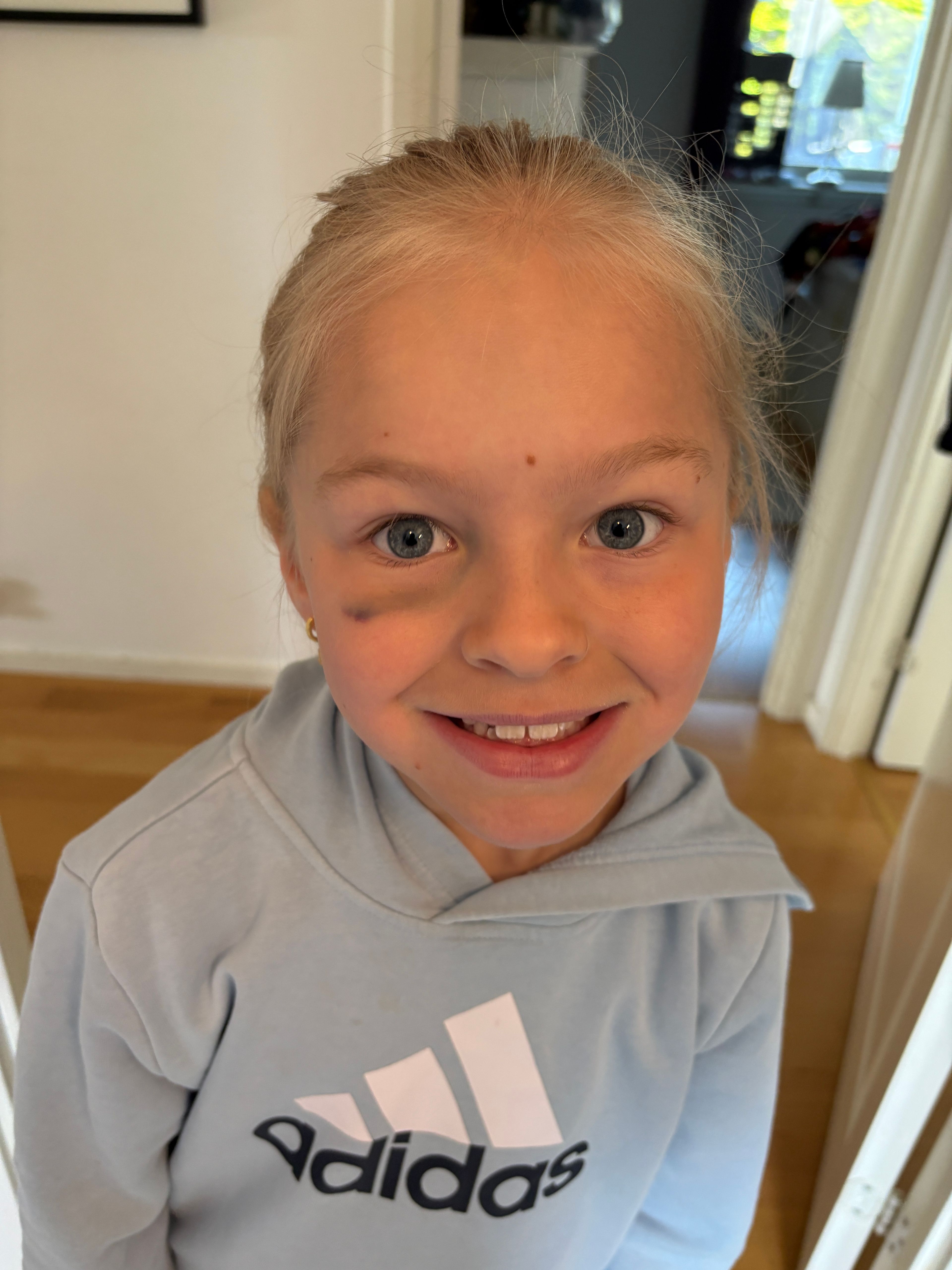 bild 0}