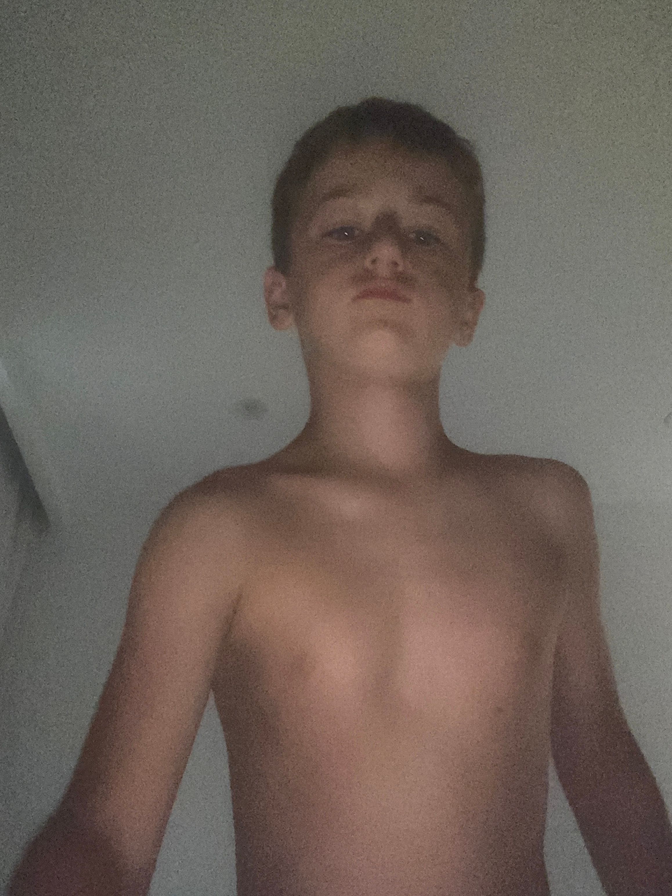 bild 0}