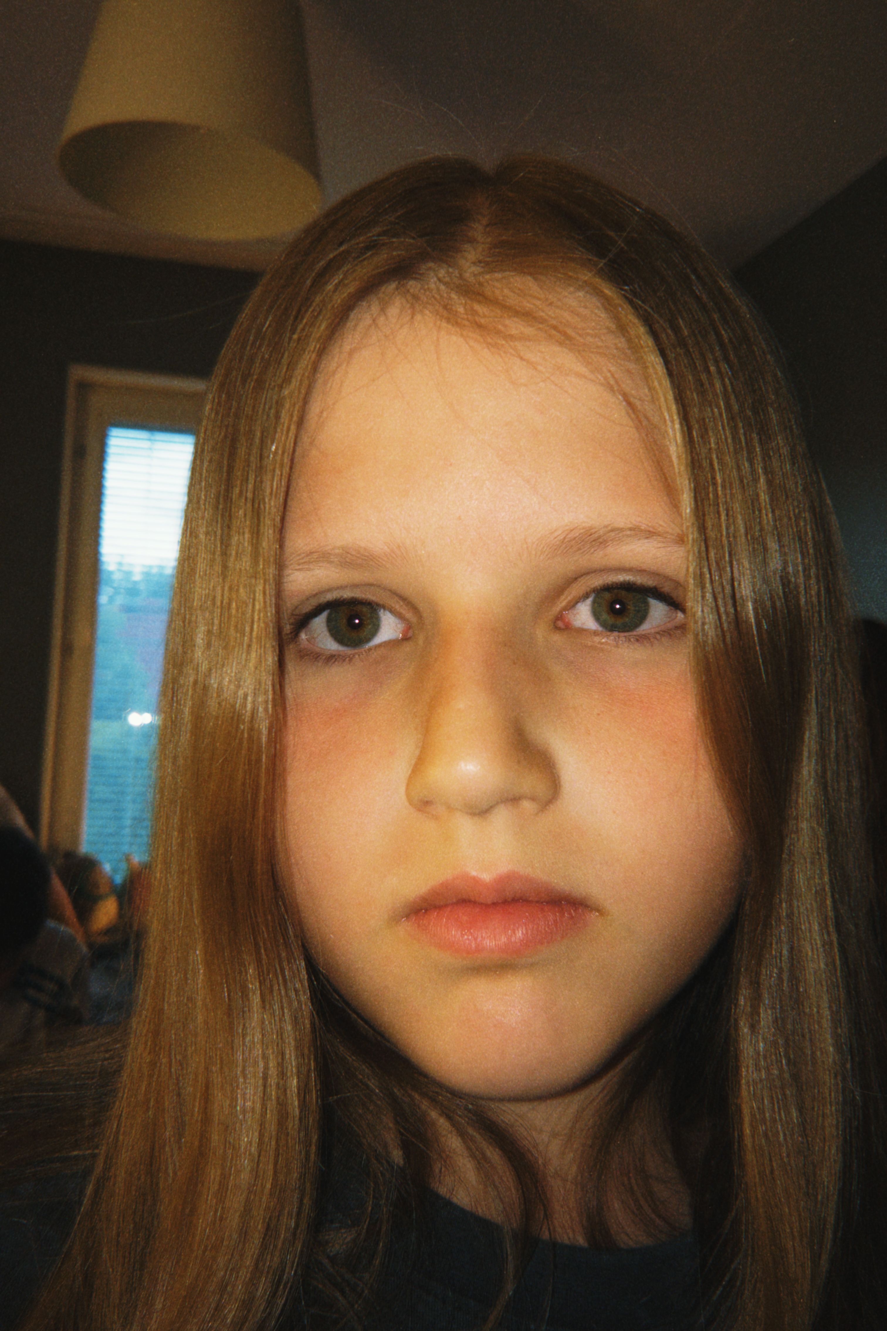 bild 0}