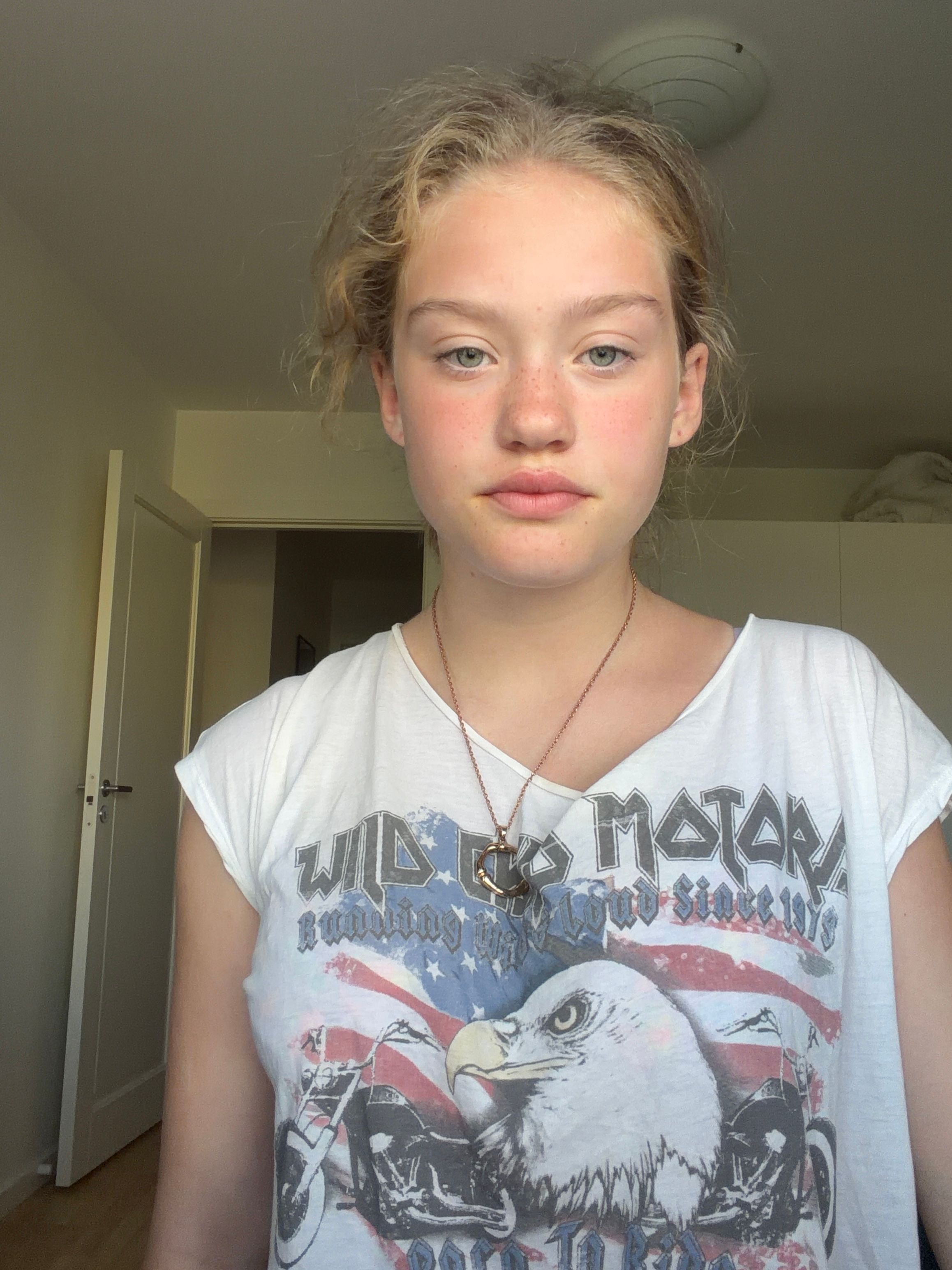 bild 2}